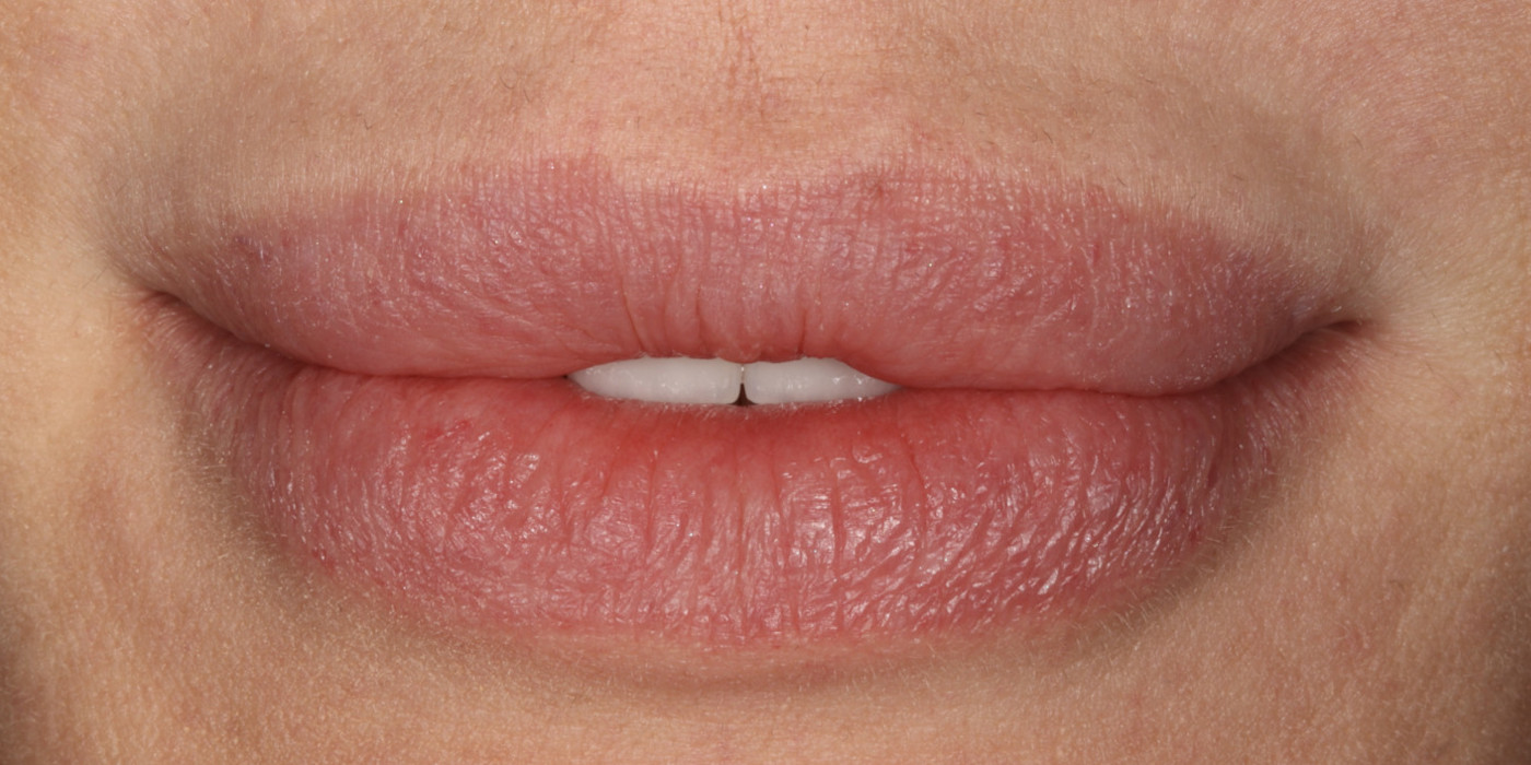 După – estetică dentară, Clinica Brânzan