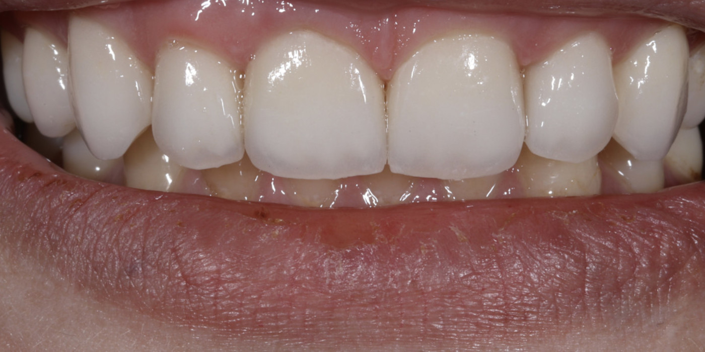 După – estetică dentară, Clinica Brânzan