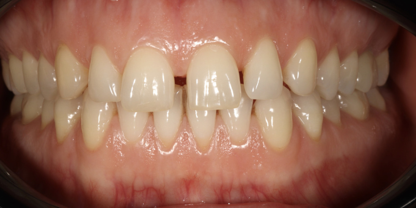 Înainte – estetică dentară, Clinica Brânzan