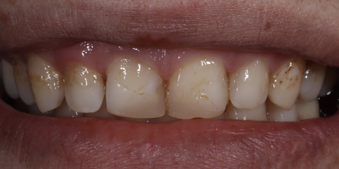 Înainte – estetică dentară, Clinica Brânzan