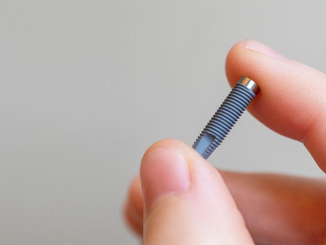 Implanturi dentare - Soluția de ultimă instanță, când dintele nu mai poate fi salvat.