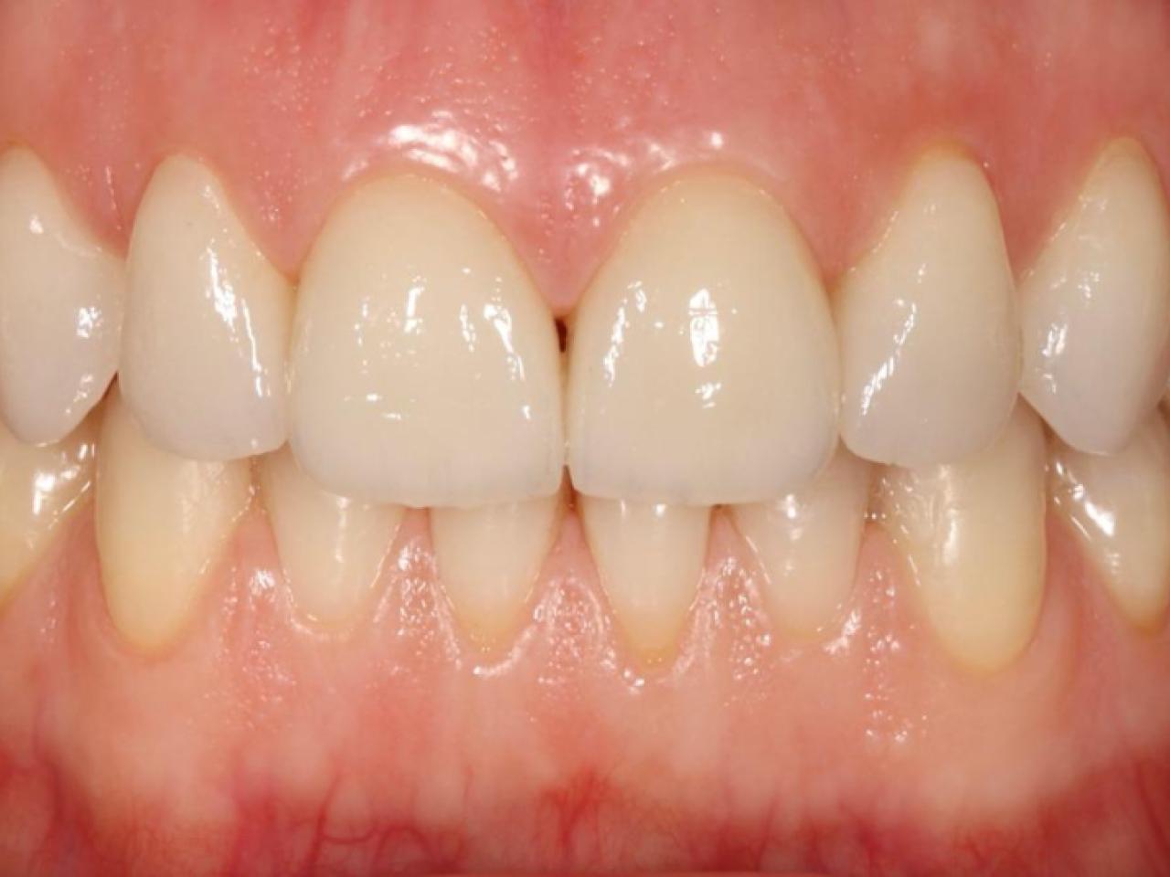 Estetică dentară - Estetica dentară înseamnă mai mult decât alb și perfect – înseamnă echilibru, proporție și respect pentru trăsăturile fiecărui pacient.