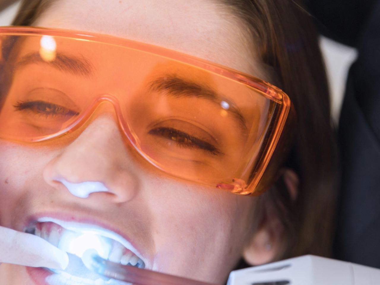 Estetică dentară - Zâmbete armonioase prin fațete, albiri și reconstrucții corecte.