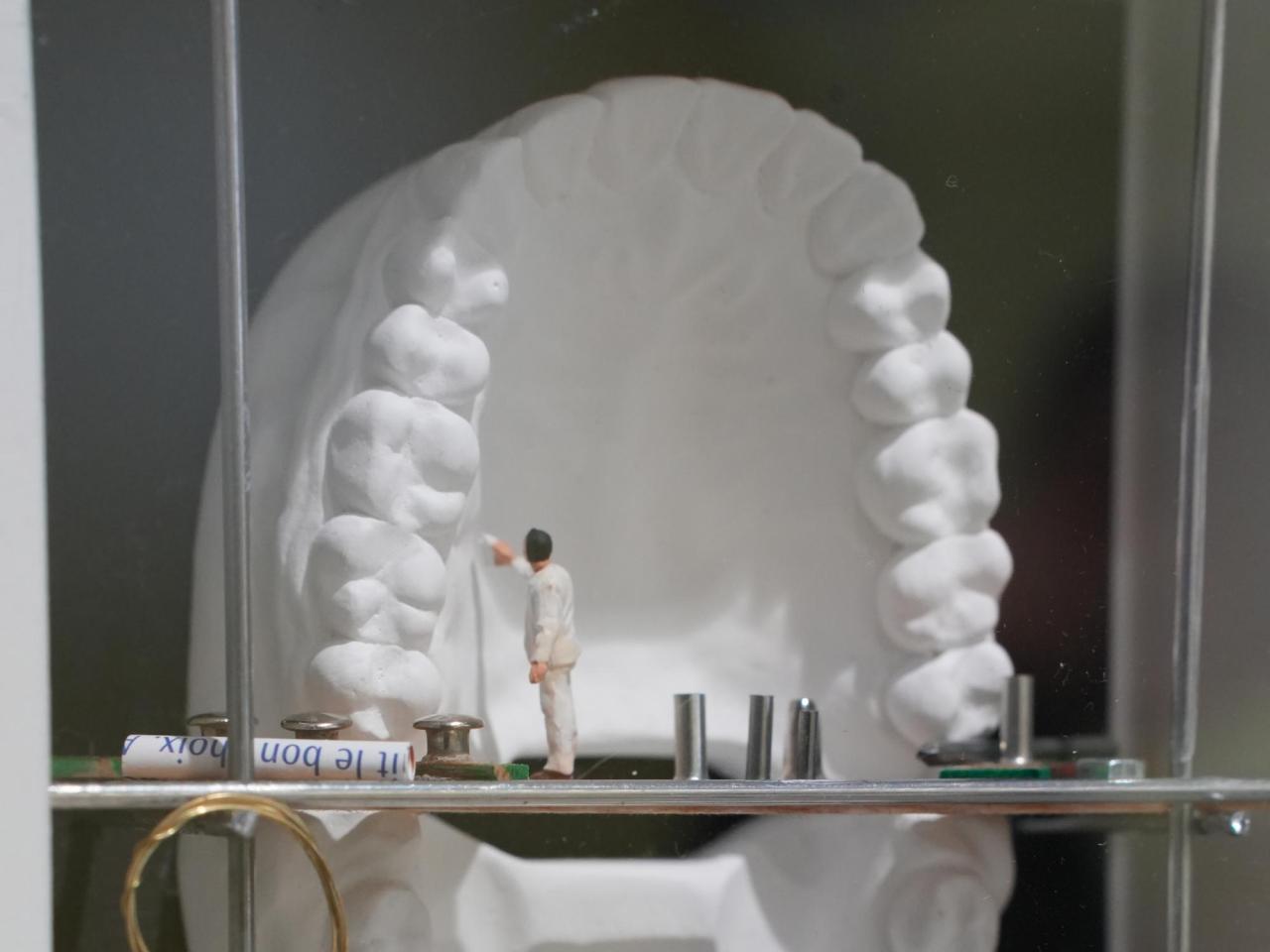 Restaurări complexe - Fiecare caz este analizat în detaliu, pentru a reda nu doar aspectul natural al zâmbetului, ci și funcționalitatea corectă a întregii danturi.