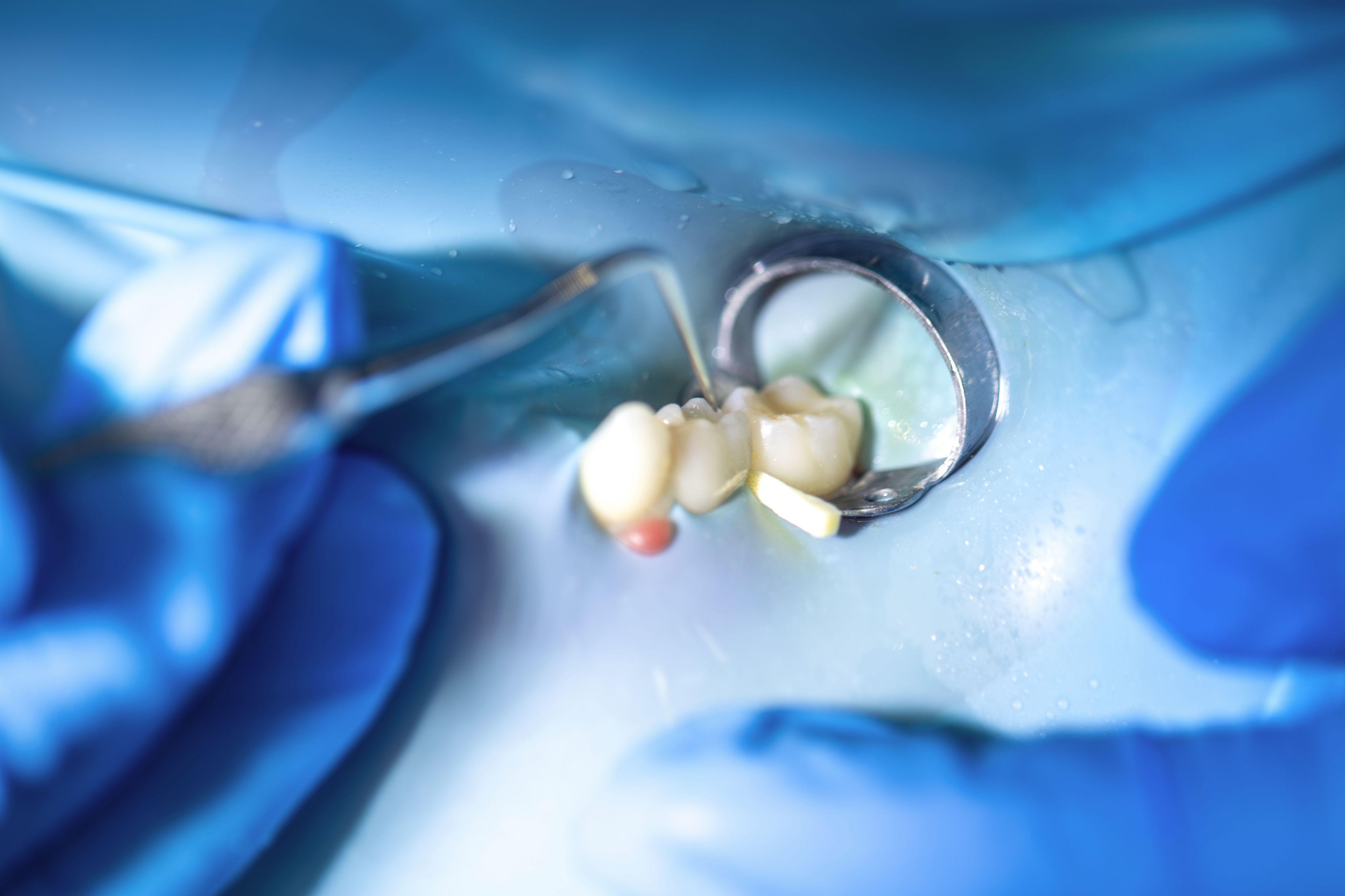 Restaurări complexe - Clinica Brânzan